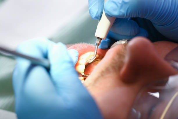Best Broken or Chipped Tooth Repair in Hudson, MI